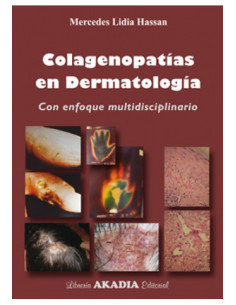 Colagenopatias En Dermatologia