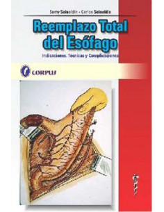 Reemplazo Total Del Esofago