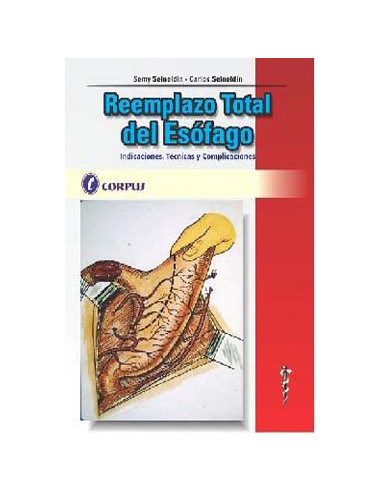 Reemplazo Total Del Esofago