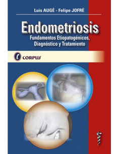 Endometriosis. Fundamentos Etiopatogenicos, Diagnostico Y Tratamiento