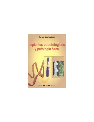 Implantes Odontologicos Y Patologia Osea