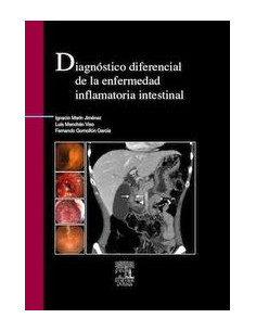 Diagnostico Diferencial De La Enfermedad Inflamatoria Intestinal