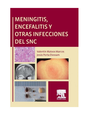 Meningitis Encefalitis Y Otras Infecciones Del Snc