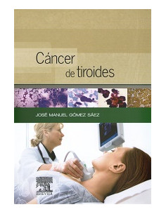 Cancer De Tiroides: Presente Y Futuro