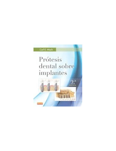 Protesis Dental Sobre Implantes 2 Ed