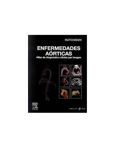 Enfermedades Aorticas
*atlas De Diagnostico Clinico Por Imagen